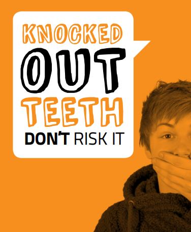 knocked out teeth don't risk it